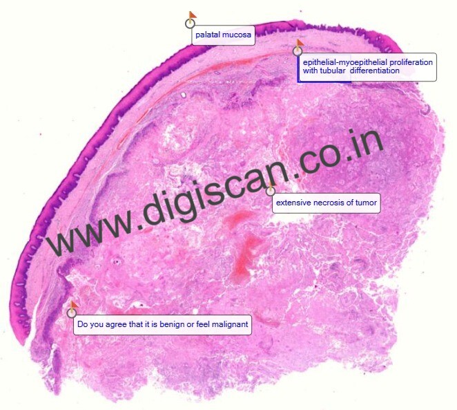 Oral Pathology Digital Slides Set (MDS & PG Students)